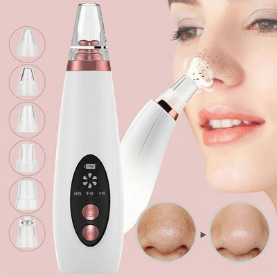 Multifunctional Pore Vacuum – Blackhead Remover for Face & Nose